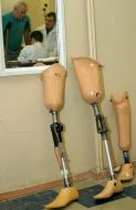 Prosthetico-orthopedic enterprise