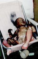 The body of the child