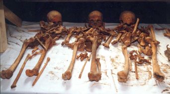Human bones