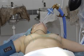 Операция по увеличению груди