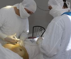 Операция по увеличению груди