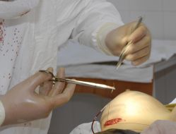 Операция по увеличению груди