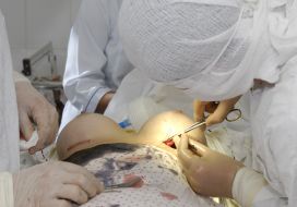 Операция по увеличению груди