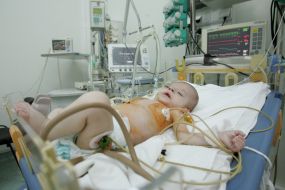 Child’s cardiologic reanimation separation