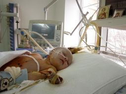 Child’s cardiologic reanimation separation