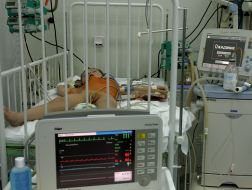 Child’s cardiologic reanimation separation