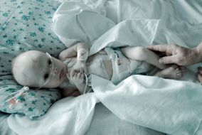 Child after heart surgery