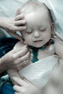 Child after heart surgery