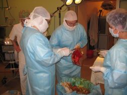 The operation on liver transplantation