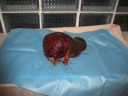 Liver