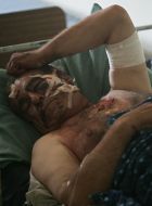 Поранений чоловік у госпіталі