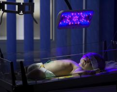 New-born child during an electrophototherapy