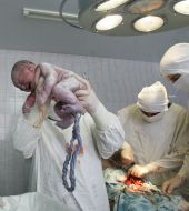 Родильное отделение