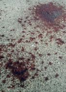 Кров на асфальті