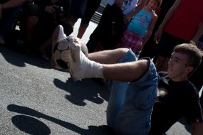 Молодой человек с гипсом на ноге