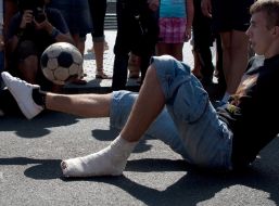 Молодой человек с гипсом на ноге