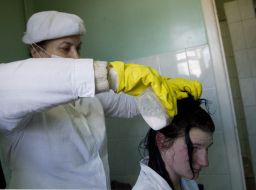 Employee center treats lice