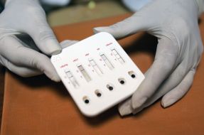 A doctor demonstrates a test