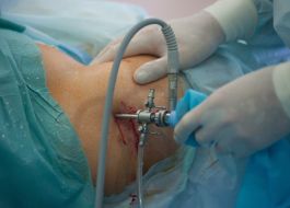 Surgeons carry out hip arthroscopy