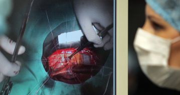 Операция по протезированию аортального клапана