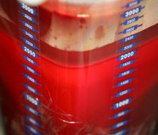 Откачанная кровь