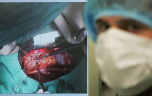 Операция по протезированию аортального клапана