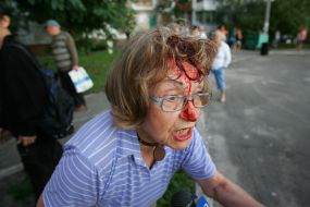 A woman with a bloody head