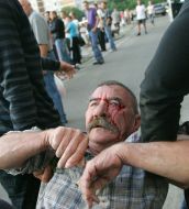 An injured man