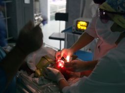 Оhthalmology operation