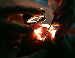 Оhthalmology operation