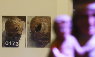 Photo of skulls on an exhibition «True rescues from death...»