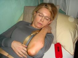 Yuliуa Timoshenko demonstrates injuries
