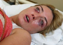 Natalуa Rozinskaya with injuries