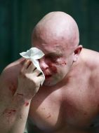 Svyatoslav Sheremet Beaten