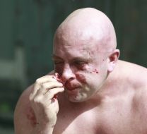 Svyatoslav Sheremet Beaten
