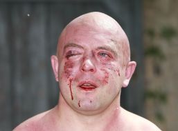 Svyatoslav Sheremet Beaten