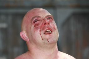 Svyatoslav Sheremet Beaten