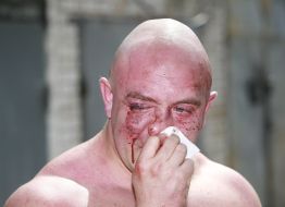 Svyatoslav Sheremet Beaten