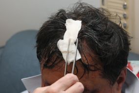 Nikolay Petruk with the broken head