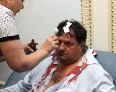 Nikolay Petruk with the broken head