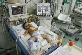 The child in the intensive care unit