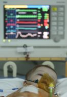 The child in the intensive care unit