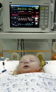 A child in the intensive care unit