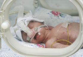 Новонароджена дитина в кювезі