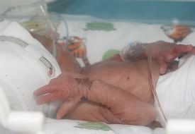 Новонароджена дитина в кювезі