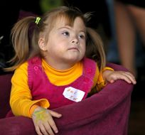 Girl with Down's syndrome