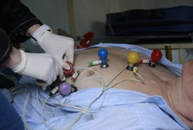 Electrocardiogram
