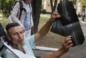 Soldier of battalion "Aydar" shows an X-ray