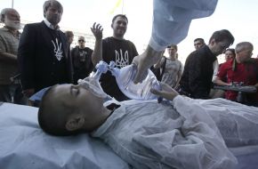 Doctors conducted surgical operation in the open air