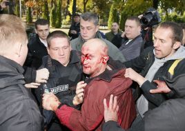 Активист с разбитым лицом